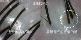 FaceColor首席設計師Fanny實際操作頭皮護理_健康的頭皮圖